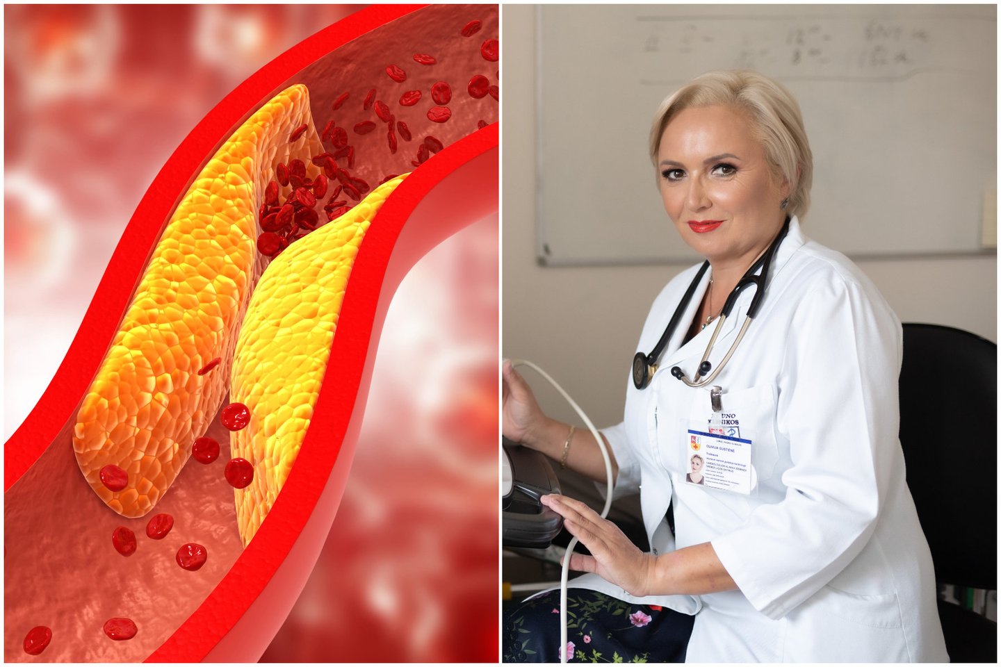 Lietuva – paskutinė Europos šalis, nekompensuojanti inovatyvių vaistų nuo cholesterolio