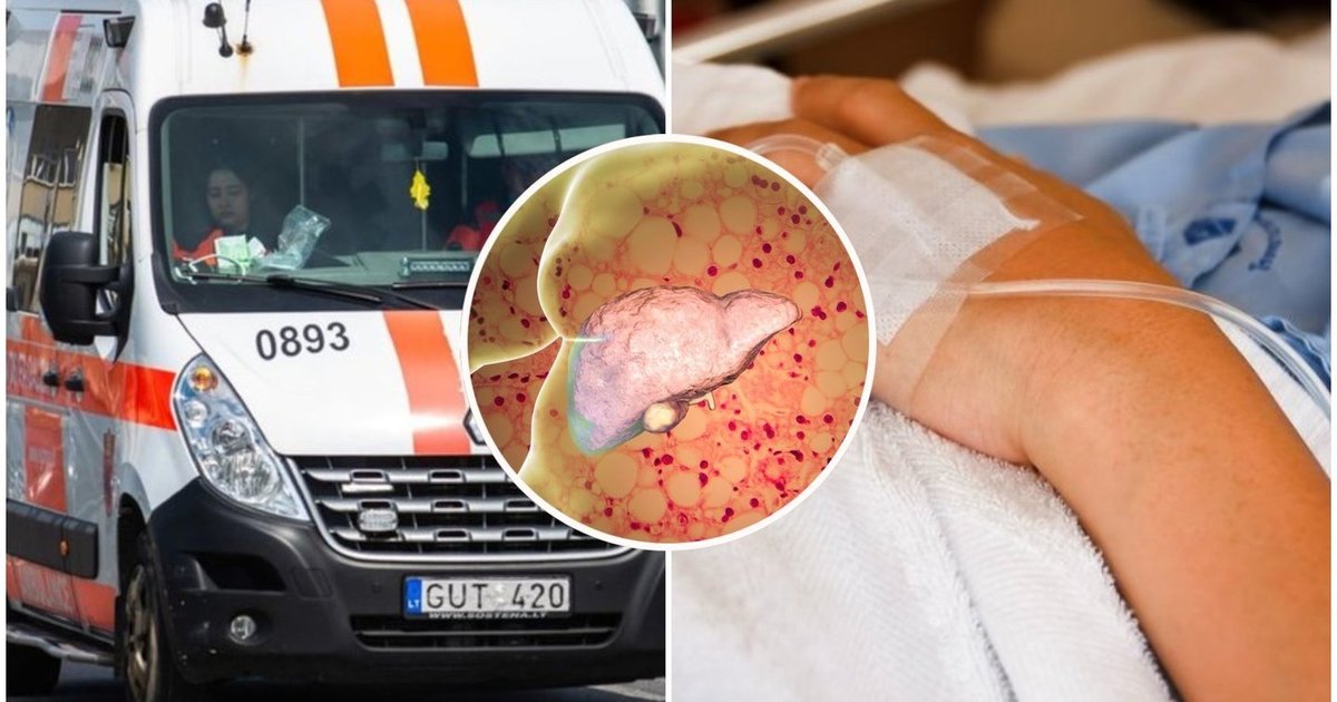 Profesorius Unikauskas 1 augalą vadina aukso gysla kepenims: žinoti verta